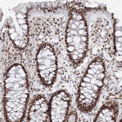 Invitrogen ZNF638 Polyclonal Antibody 100 &mu;L; Unconjugated:Antibodies,