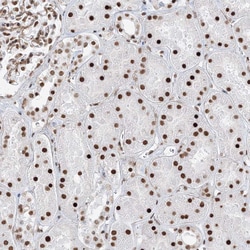 Invitrogen ZNF638 Polyclonal Antibody 100 &mu;L; Unconjugated:Antibodies,