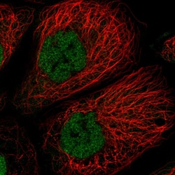 Invitrogen TCF20 Polyclonal Antibody 100 &mu;L; Unconjugated:Antibodies,