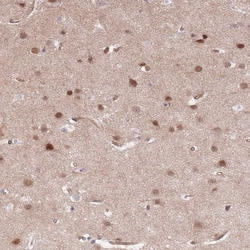 Invitrogen TCF20 Polyclonal Antibody 100 &mu;L; Unconjugated:Antibodies,