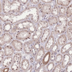 Invitrogen TCF20 Polyclonal Antibody 100 &mu;L; Unconjugated:Antibodies,