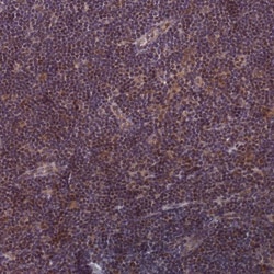 Invitrogen TCF20 Polyclonal Antibody 100 &mu;L; Unconjugated:Antibodies,