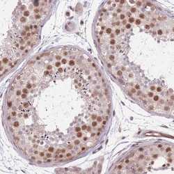 Invitrogen TCF20 Polyclonal Antibody 100 &mu;L; Unconjugated:Antibodies,