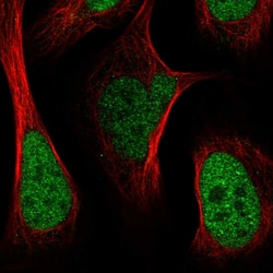Invitrogen HAT1 Polyclonal Antibody 100 &mu;L; Unconjugated:Antibodies,