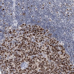 Invitrogen HAT1 Polyclonal Antibody 100 &mu;L; Unconjugated:Antibodies,