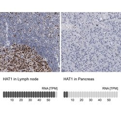 Invitrogen HAT1 Polyclonal Antibody 100 &mu;L; Unconjugated:Antibodies,