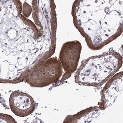 Invitrogen GPN1 Polyclonal Antibody 100 &mu;L | Buy Online | Invitrogen&trade; | Fisher Scientific