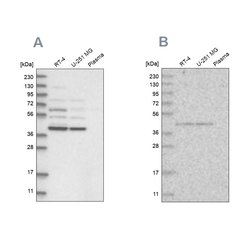 Invitrogen GPN1 Polyclonal Antibody 100 &mu;L | Buy Online | Invitrogen&trade; | Fisher Scientific