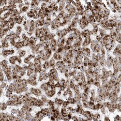 Invitrogen DNAH1 Polyclonal Antibody 100 &mu;L; Unconjugated:Antibodies,