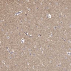 Invitrogen MED12L Polyclonal Antibody 100 &mu;L; Unconjugated:Antibodies,
