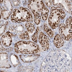 Invitrogen NGLY1 Polyclonal Antibody 100 &mu;L; Unconjugated:Antibodies,