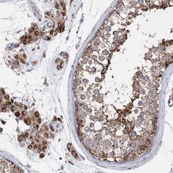 Invitrogen NGLY1 Polyclonal Antibody 100 &mu;L; Unconjugated:Antibodies,