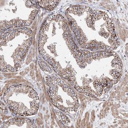 Invitrogen NGLY1 Polyclonal Antibody 100 &mu;L; Unconjugated:Antibodies,