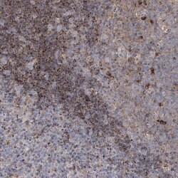 Invitrogen NGLY1 Polyclonal Antibody 100 &mu;L; Unconjugated:Antibodies,