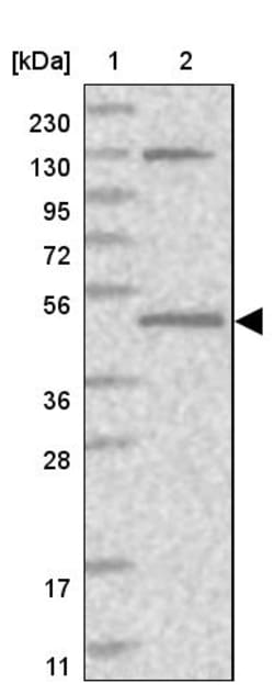 Invitrogen QTRTD1 Polyclonal Antibody 100 &mu;L; Unconjugated:Antibodies,