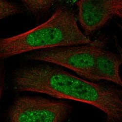 Invitrogen TRIP12 Polyclonal Antibody 100 &mu;L; Unconjugated:Antibodies,