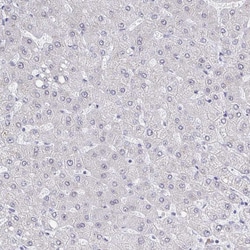 Invitrogen TRIP12 Polyclonal Antibody 100 &mu;L; Unconjugated:Antibodies,