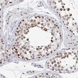 Invitrogen TRIP12 Polyclonal Antibody 100 &mu;L; Unconjugated:Antibodies,