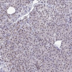 Invitrogen TRIP12 Polyclonal Antibody 100 &mu;L; Unconjugated:Antibodies,