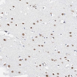 Invitrogen PRMT9 Polyclonal Antibody 100 &mu;L; Unconjugated:Antibodies,