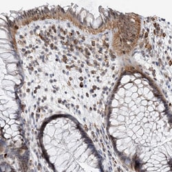 Invitrogen PRMT9 Polyclonal Antibody 100 &mu;L; Unconjugated:Antibodies,