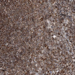 Invitrogen PRMT9 Polyclonal Antibody 100 &mu;L; Unconjugated:Antibodies,