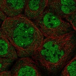 Invitrogen DALRD3 Polyclonal Antibody 100 &mu;L; Unconjugated:Antibodies,