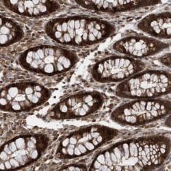 Invitrogen DALRD3 Polyclonal Antibody 100 &mu;L; Unconjugated:Antibodies,