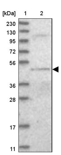Invitrogen DALRD3 Polyclonal Antibody 100 &mu;L; Unconjugated:Antikroppar