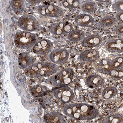 Invitrogen COPB2 Polyclonal Antibody 100 &mu;L; Unconjugated:Antibodies,