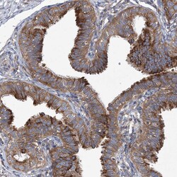 Invitrogen COPB2 Polyclonal Antibody 100 &mu;L; Unconjugated:Antibodies,