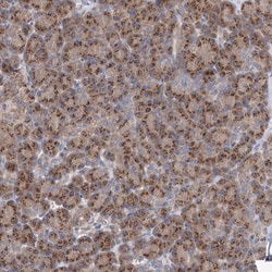 Invitrogen COPB2 Polyclonal Antibody 100 &mu;L; Unconjugated:Antibodies,