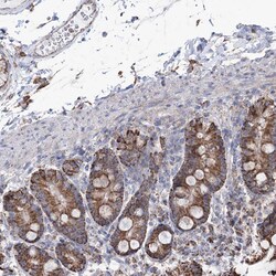 Invitrogen CWF19L1 Polyclonal Antibody 100 &mu;L; Unconjugated:Antibodies,