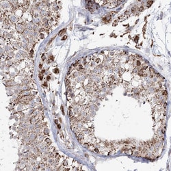 Invitrogen CWF19L1 Polyclonal Antibody 100 &mu;L; Unconjugated:Antibodies,