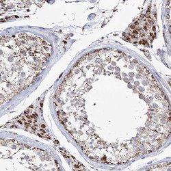 Invitrogen CWF19L1 Polyclonal Antibody 100 &mu;L; Unconjugated:Antibodies,