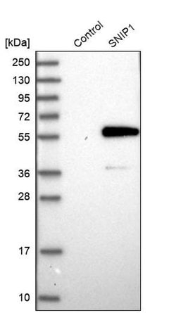 Invitrogen SNIP1 Polyclonal Antibody 100 &mu;L | Buy Online | Invitrogen&trade; | Fisher Scientific