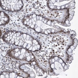 Invitrogen DCLRE1A Polyclonal Antibody 100 &mu;L; Unconjugated:Antibodies,