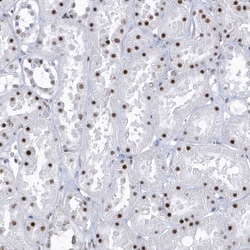 Invitrogen DCLRE1A Polyclonal Antibody 100 &mu;L; Unconjugated:Antibodies,