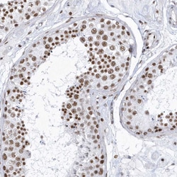 Invitrogen DCLRE1A Polyclonal Antibody 100 &mu;L; Unconjugated:Antibodies,