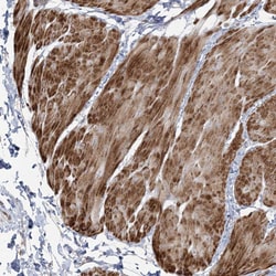 Invitrogen NUDT9 Polyclonal Antibody 100 &mu;L; Unconjugated:Antibodies,