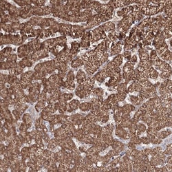 Invitrogen PSMD6 Polyclonal Antibody 100 &mu;L; Unconjugated:Antistoffer