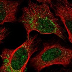 Invitrogen OPA1 Polyclonal Antibody 100 &mu;L; Unconjugated:Antibodies,