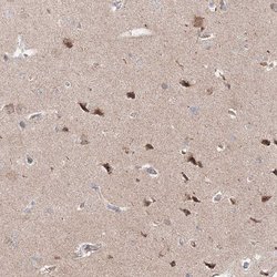 Invitrogen OPA1 Polyclonal Antibody 100 &mu;L; Unconjugated:Antibodies,