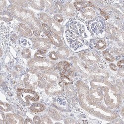 Invitrogen OPA1 Polyclonal Antibody 100 &mu;L; Unconjugated:Antibodies,