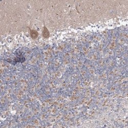 Invitrogen OPA1 Polyclonal Antibody 100 &mu;L; Unconjugated:Antibodies,
