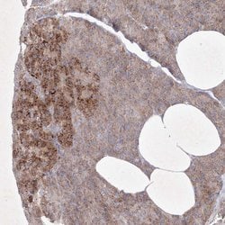 Invitrogen OPA1 Polyclonal Antibody 100 &mu;L; Unconjugated:Antibodies,