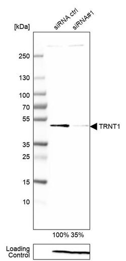 Invitrogen TRNT1 Polyclonal Antibody 100 &mu;L; Unconjugated:Antibodies,