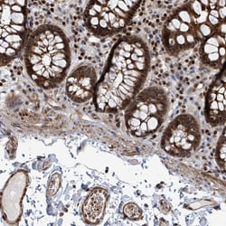 Invitrogen DNMT2 Polyclonal Antibody 100 &mu;L; Unconjugated:Antibodies,