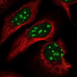 Invitrogen DNMT2 Polyclonal Antibody 100 &mu;L; Unconjugated:Antibodies,