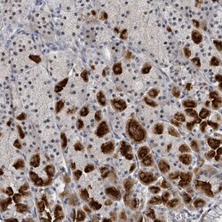 Invitrogen DNMT2 Polyclonal Antibody 100 &mu;L; Unconjugated:Antibodies,
